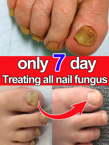 anti-infection gel care product